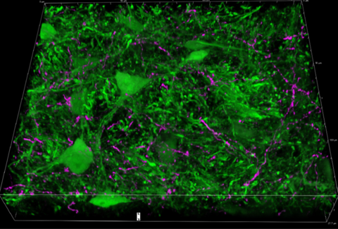 Mouse brain stem inhibitory neurons (green) activated by amygdala inputs (magenta neuronal processes).